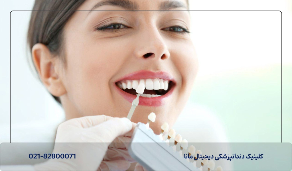 عوارض و معایب دندان خرگوشی کامپوزیت