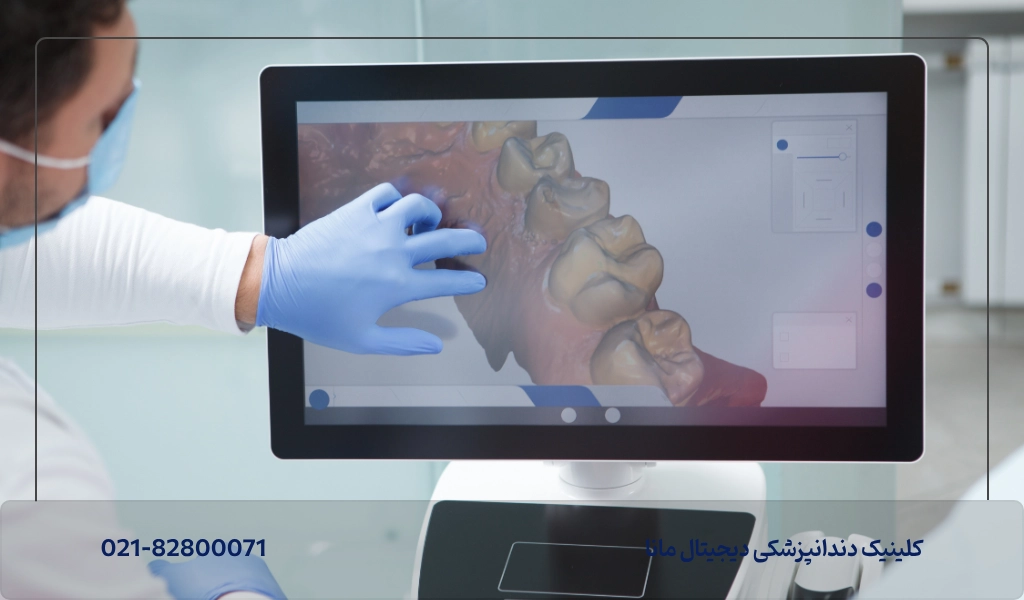 اصلیترین فرق های ایمپلنت دیجیتال و سنتی