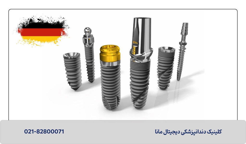 ایمپلنت آلمانی خوبه یا نه؟