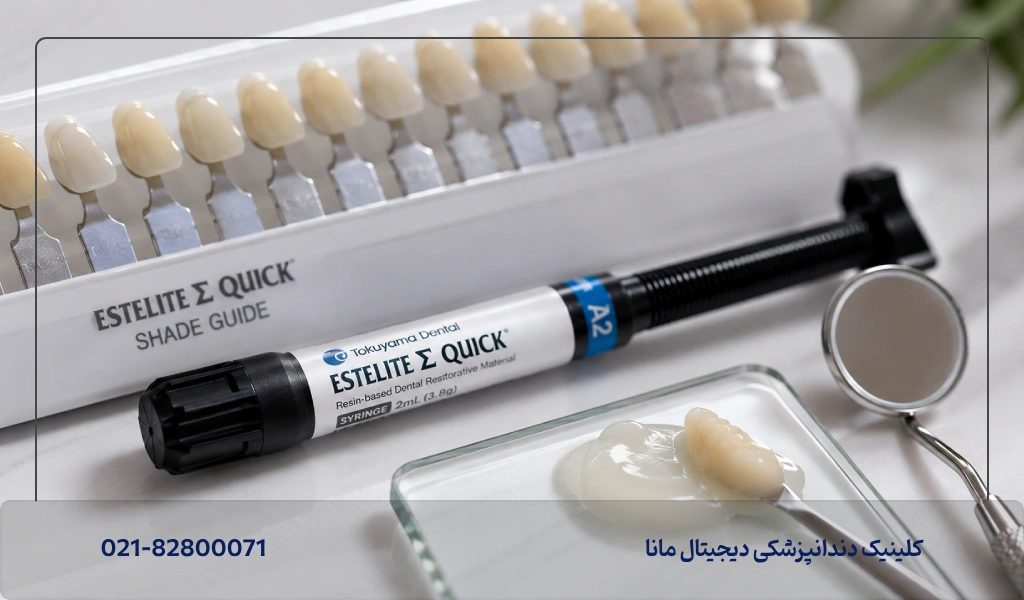 کامپوزیت توکویاما (Tokuyama) یکی از بهترین مارک های کامپوزیت در ایران