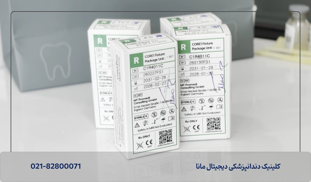 بهترین برندهای ایمپلنت کرهای چیست؟