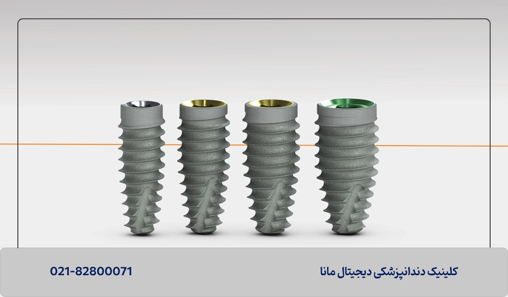 معایب و عوارض احتمالی ایمپلنت سوئیسی و نظرات بیماران