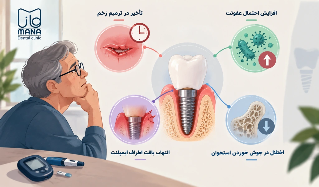 آیا ایمپلنت برای افراد دیابتی ضرر دارد؟