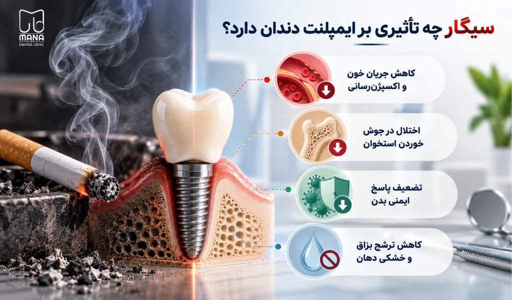 سیگار چه تأثیری بر ایمپلنت دندان دارد؟