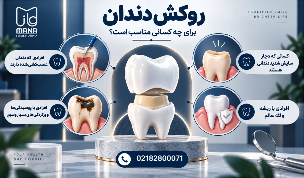 روکش دندان برای چه کسانی مناسب است