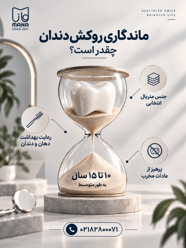 ماندگاری روکش دندان چقدر است؟
