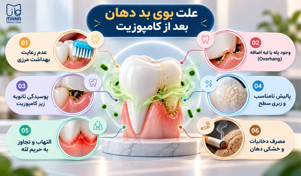 چرا بعد از کامپوزیت دهان بو میگیرد؟؛ علت بوی بد دهان بعد از کامپوزیت